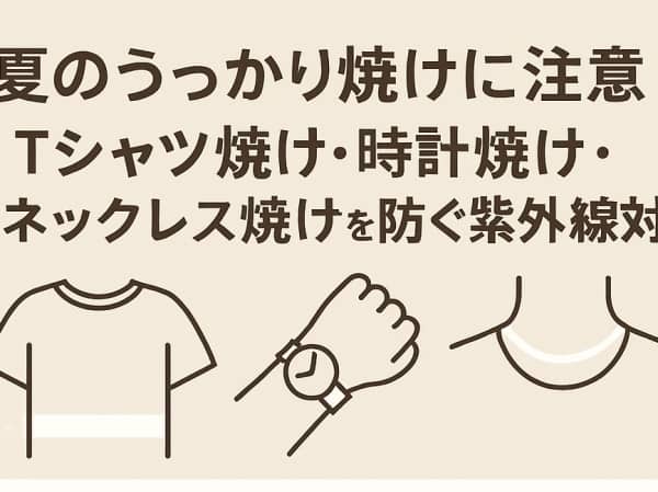 夏のうっかり焼けに注意！