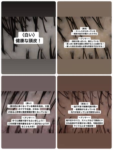 今更聞けないヘッドスパの効果とは！？