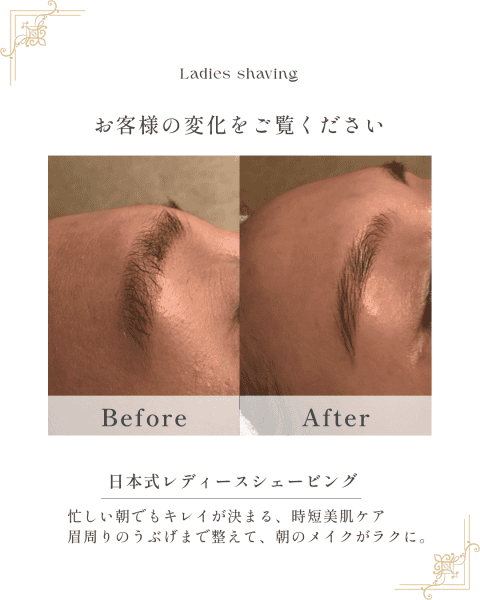 【スキンケア】ホーチミンで叶える、レディースシェービング